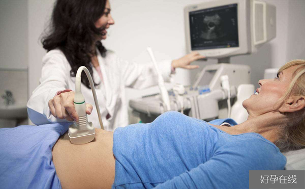 多囊卵巢可以促排怀孕吗